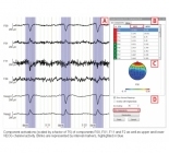 EEG Ocular Correction ICA (based on ICA)