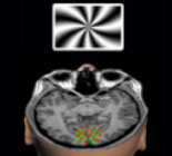 Functional Brain Imaging